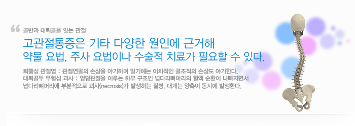 고관절통증은 기타 다양한 원인에 근거해 약물 요법, 주사 요법이나 수술적 치료가 필요할 수 있다.